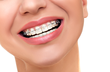 機能的できれいな歯並びを矯正歯科治療を専門に行う歯科医師が実現します