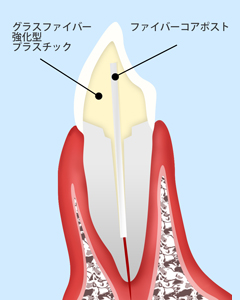 ファイバーコア