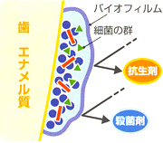 虫歯になる危機は3ヶ月周期で訪れます